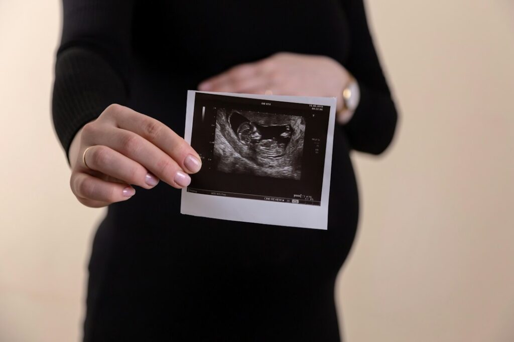 Pregnant person holding an ultrasound photograph, illustrating prenatal imaging generally; the research featured in the article concerns MRI, not ultrasound.